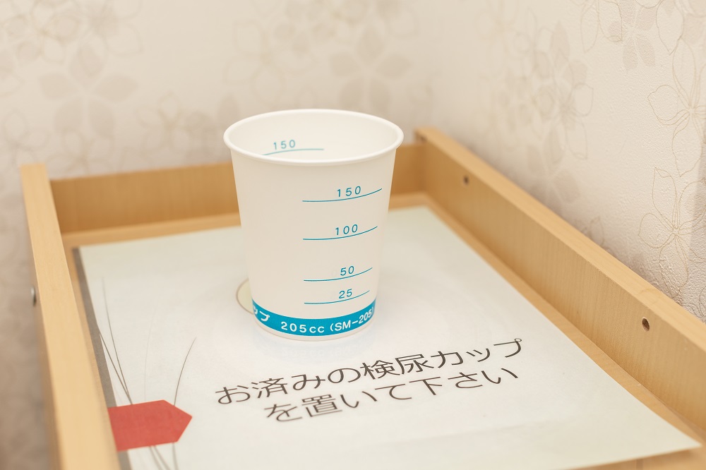 尿検査